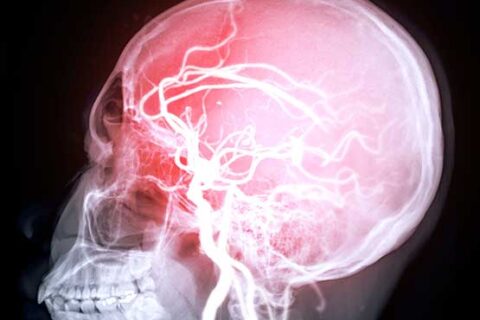 ΚΡΑΝΙΟΠΛΑΣΤΙΚΗ