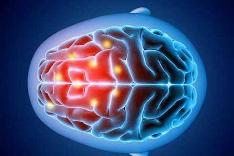 ΟΓΚΟΣ ΕΓΚΕΦΑΛΟΥ & ΣΠΟΝΔΥΛΙΚΗΣ ΣΤΗΛΗΣ