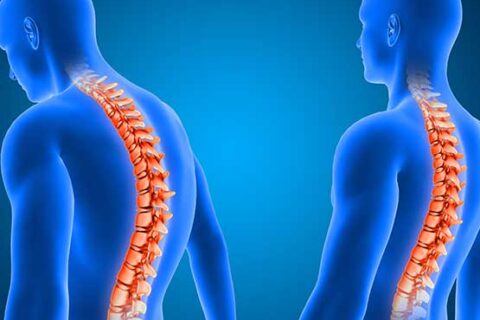 ΠΑΘΗΣΕΙΣ ΣΠΟΝΔΥΛΙΚΗΣ ΣΤΗΛΗΣ