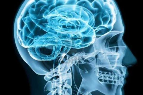 ΥΔΡΟΚΕΦΑΛΟΣ